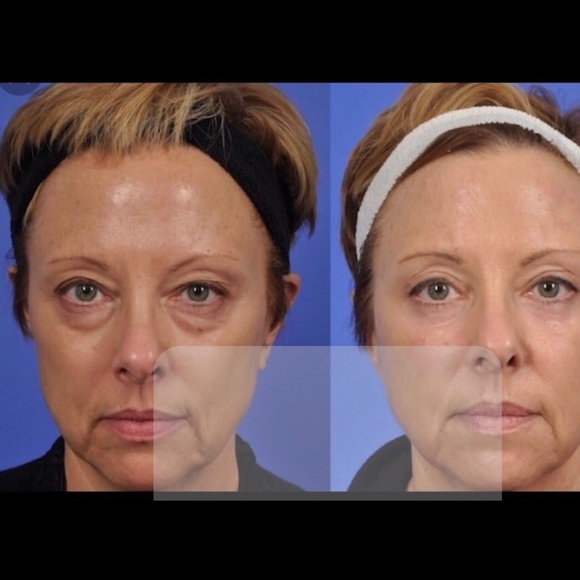 DAY AND NIGHT AGE RECOVERY CREAM SERUMS BOTH 2 OZ - Picture 2 of 3